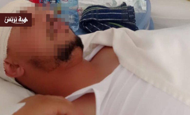 سيدي محمد الحمر.. ضحية اعتداء يكشف معاناته بعد حكم قضائي أثار الجدل